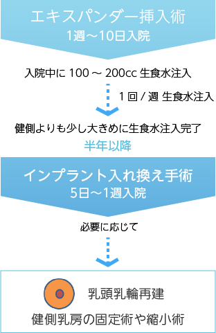 乳房再建の流れ